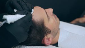 The Best Scalp Micropigmentation Treatment Aftercare Tips