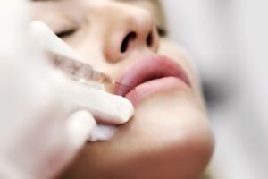 Trends in Injectable Cosmetology: Korean Dermal Fillers